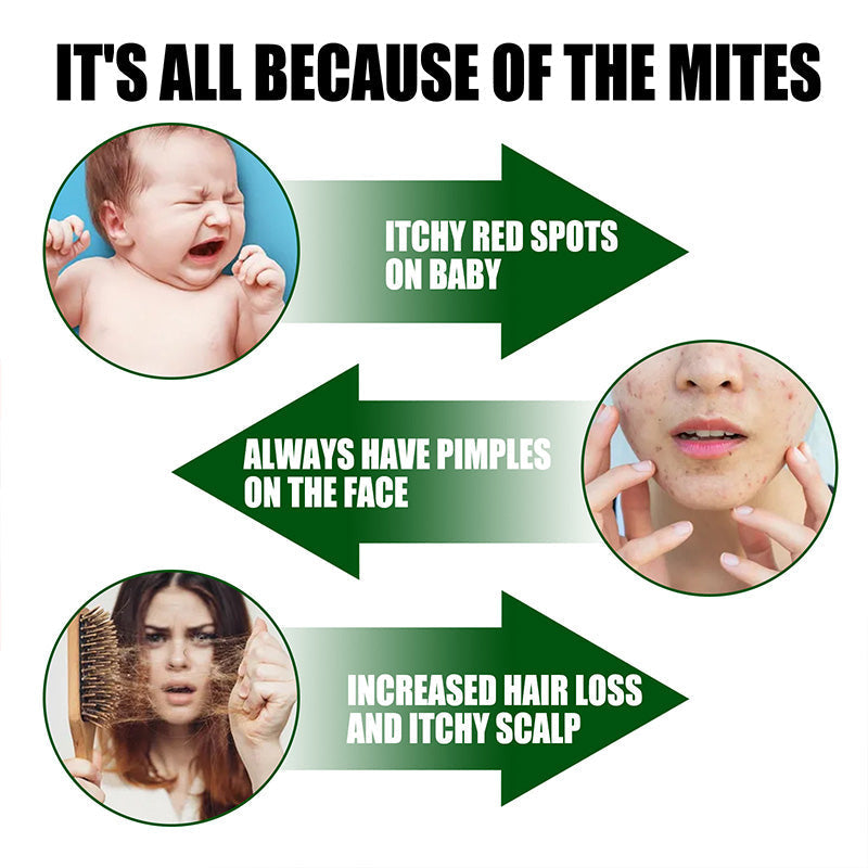 ⚡Wyprzedaż limitowana Kup 2 i otrzymaj 1 gratis⚡-🧑‍⚕️Silny spray do usuwania roztoczy