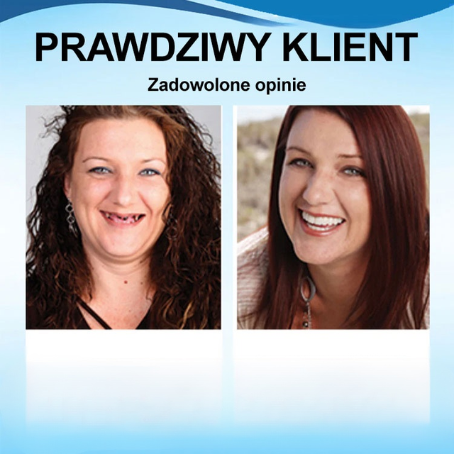 Idealny zestaw protez do perfekcyjnego uśmiechu