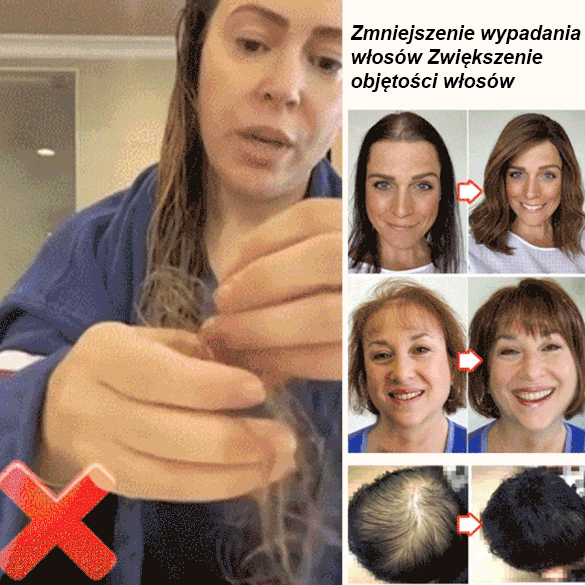 Serum w kulce wzmacniające cebulki włosów i zapobiegające wypadaniu.