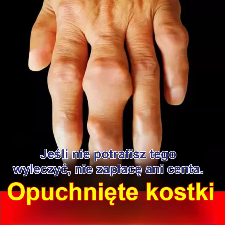 【Ulga w mięśniach i ulga w kościach Szybka ulga w bólu】 Krem kostny Miao Jiang