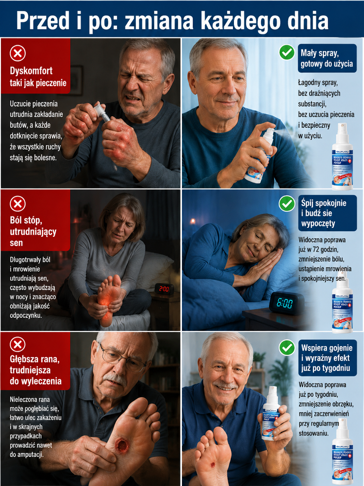 【Pięciokrotne przyspieszenie gojenia】Spray do pielęgnacji stóp dla diabetyków